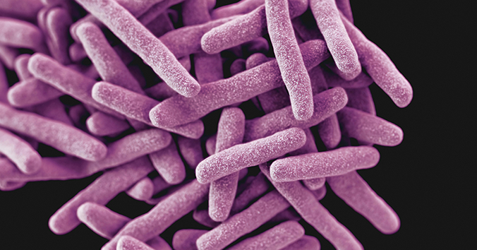 Tuberkulos-Foto-av-CDC-Pixabay