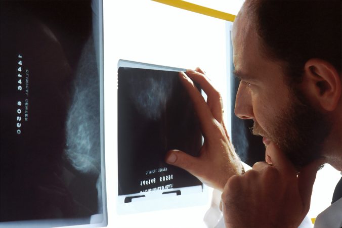Radiolog som tittar på bilder, foto av National Cancer Institute på Unsplash