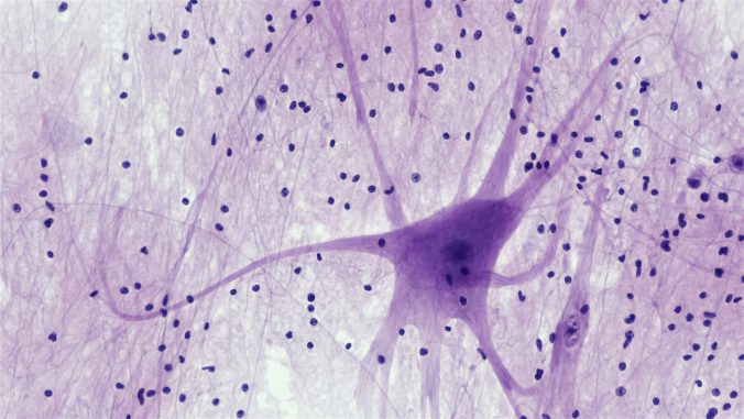 Neuron, foto: Bioscience Image Library by Fayette Reynolds.